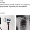 Portable Handheld X-ray Machine for Clinical & Emergency Diagnostic Use