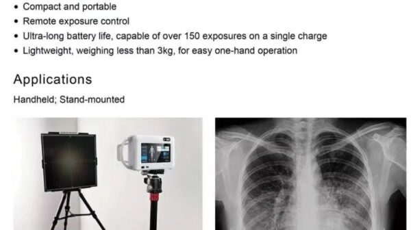 Portable Handheld X-ray Machine for Clinical & Emergency Diagnostic Use